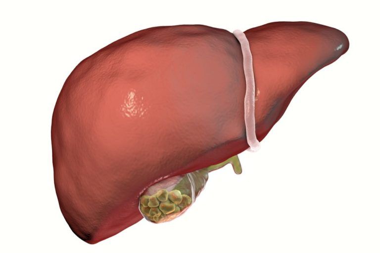 https://s16736.pcdn.co/wp-content/uploads/sites/450/2018/01/Gallbladder-Disease-768x512.jpg.optimal.jpg