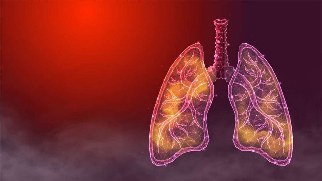 লান্স ক্যান্সার (Lung Cancer) কি এবং তার হওয়ার লক্ষণ কি? লান্স ক্যান্সার (Lung Cancer) কি এবং তার হওয়ার লক্ষণ কি?