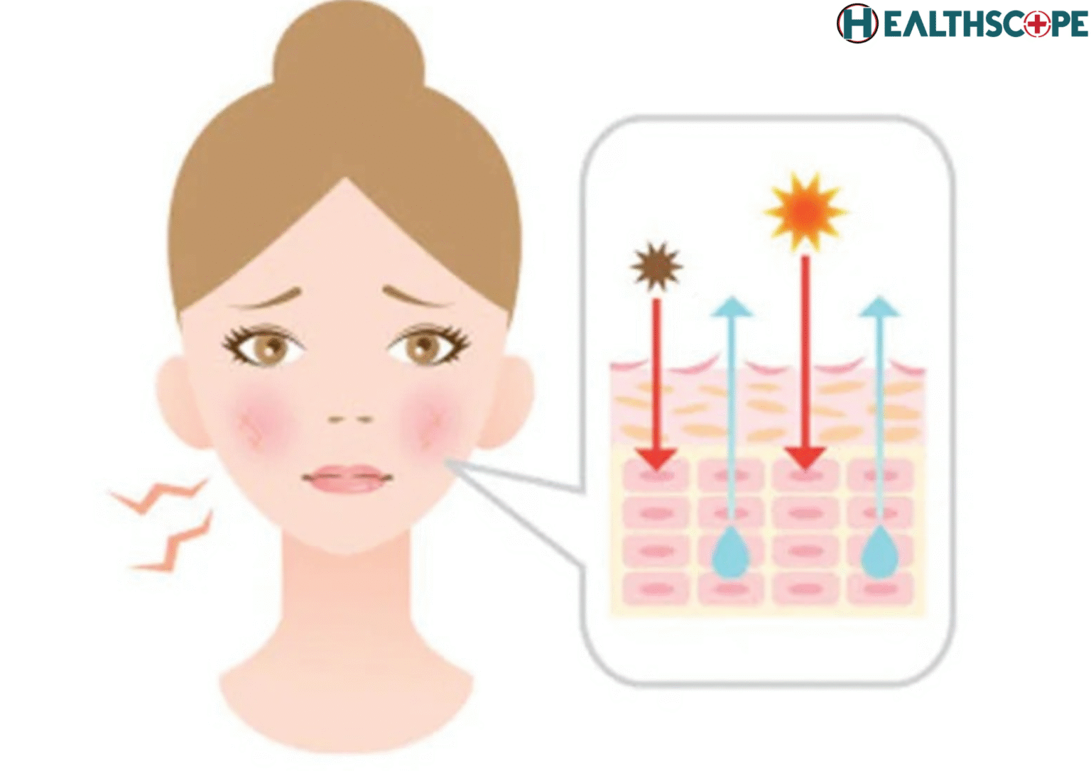 পিগমেন্টেশন (Pigmentation) হওয়ার লক্ষণ ও তার প্রতিকার