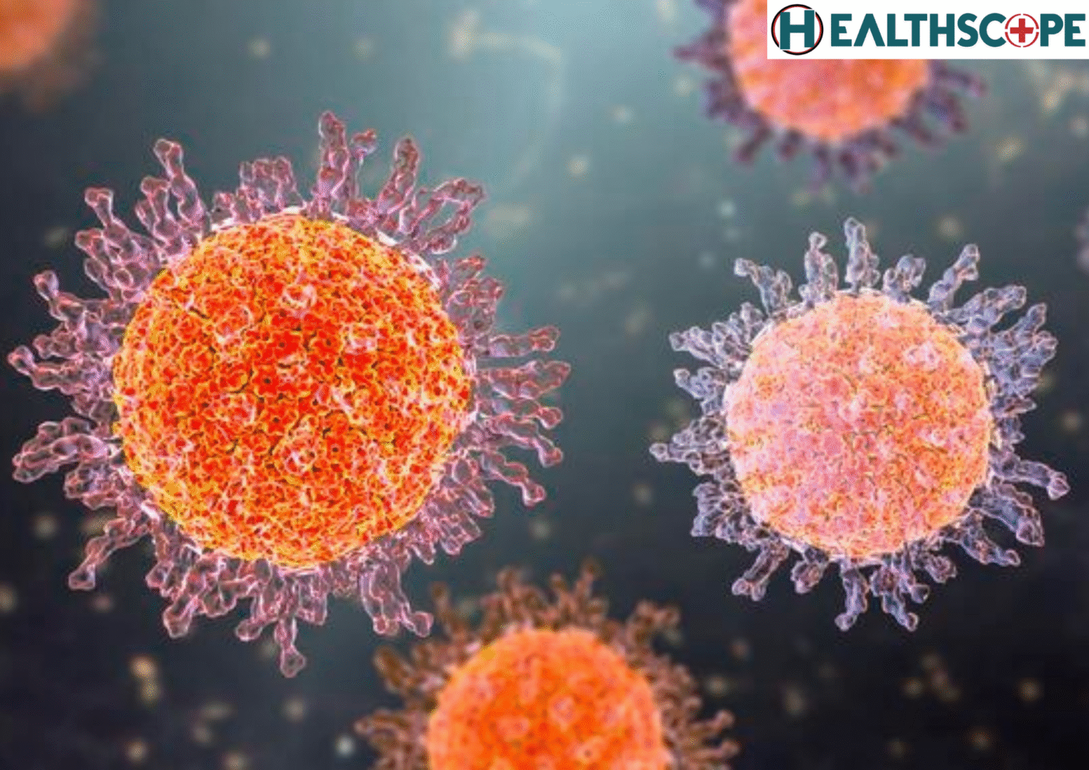 ফ্যালেঞ্জাইটিস (Phalangitis) হওয়ার লক্ষণ কি?