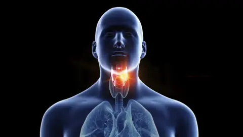 গলায় ক্যান্সার (Throat Cancer) হওয়ার লক্ষণ কি? গলায় ক্যান্সার (Throat Cancer) হওয়ার লক্ষণ কি?